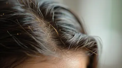Natural Remedies for Dandruff-Free Hair