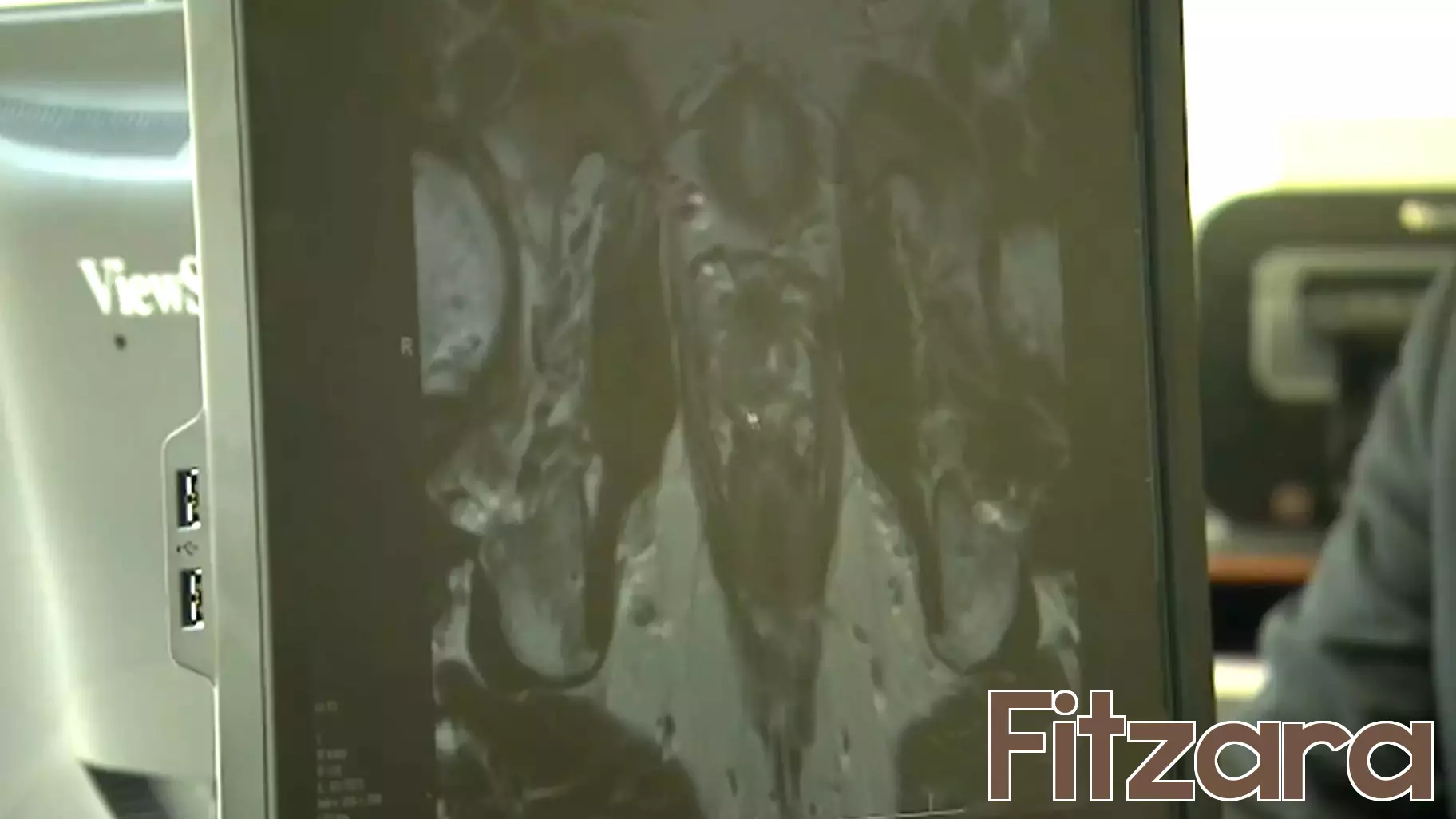 Health Alert: Doctors Encourage Men to Prioritize Preventative Care