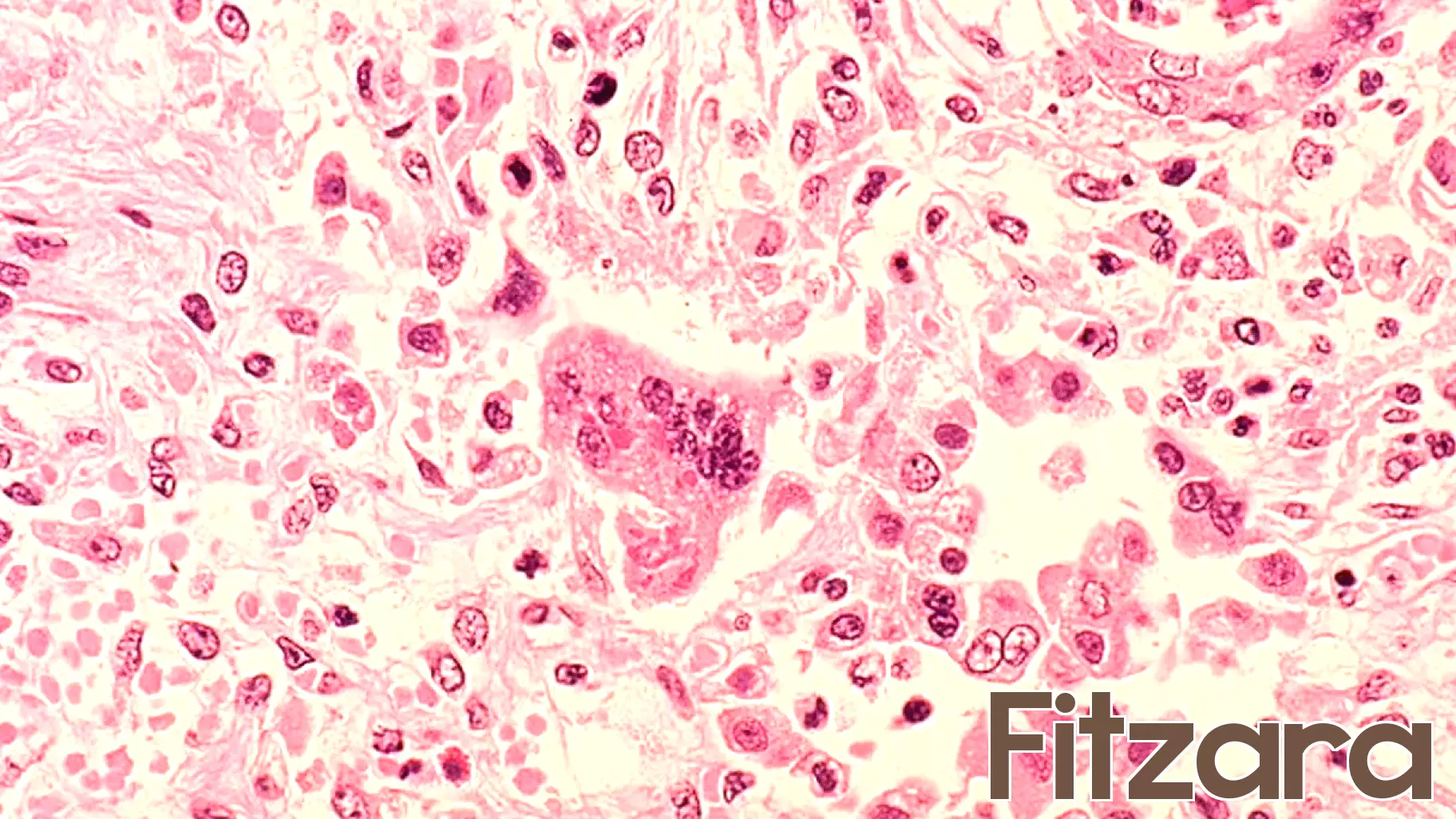 Health Officials Warn of Measles Exposure in D.C., Maryland, and Virginia