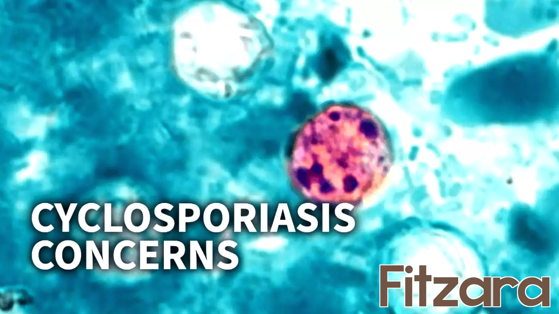 North Carolina reports an increase in cyclosporiasis cases, health officials say