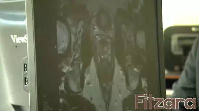 Health Alert: Doctors Encourage Men to Prioritize Preventative Care