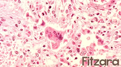 Health Officials Warn of Measles Exposure in D.C., Maryland, and Virginia